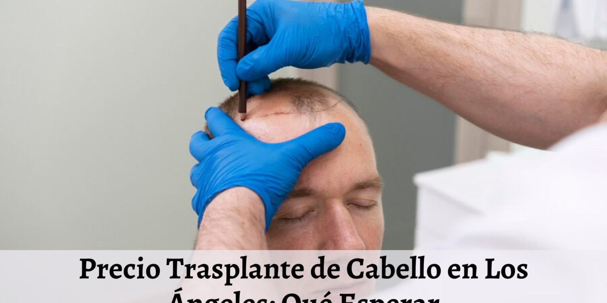 Precio Trasplante de Cabello en Los Ángeles: Qué Esperar